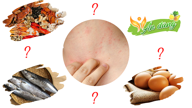 KHÓA TẬP HUẤN XÂY DỰNG VĂN HÓA AN TOÀN THỰC PHẨM VÀ CÁC BIỆN PHÁP KIỂM SOÁT, GHI NHÃN CHẤT GÂY DỊ ỨNG TRONG SẢN PHẨM THỦY SẢN XUẤT KHẨU